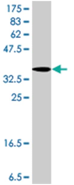 PTCH, Mouse, Polyclonal Antibody, Abnova 50&mu;L; Unlabeled:Antibodies,