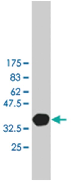 PTCH, Mouse, Clone: 1B7, Abnova 200&mu;L; Unlabeled:Antibodies, Monoclonal