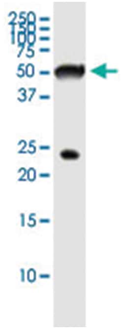 PTEN, Human, IP-WB Antibody Pair (PW3), Abnova™