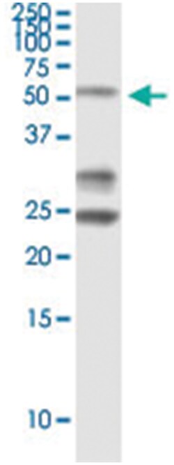 PTEN, Human, IP-WB Antibody Pair (PW4), Abnova&trade;