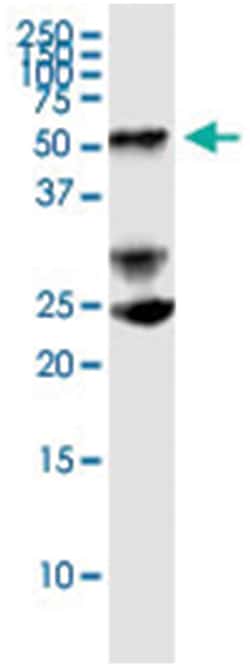 PTEN, Human, IP-WB Antibody Pair (PW5), Abnova&trade;
