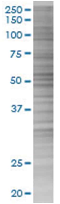 PTEN 293T Cell Overexpression Lysate 2 (Denatured), Abnova 100&mu;L | Buy Online | Abnova | Fisher Scientific