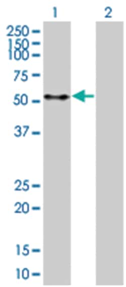 PTEN 293T Cell Overexpression Lysate 2 (Denatured), Abnova 100&mu;L | Buy Online | Abnova | Fisher Scientific