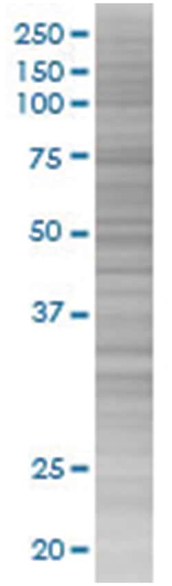 PTGER2 293T Cell Overexpression Lysate (Denatured), Abnova 100&mu;L | Buy Online | Abnova | Fisher Scientific
