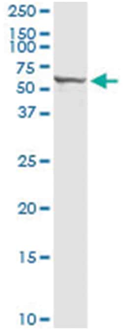 anti-PTGIS, Human, IP-WB Antibody Pair, Abnova&trade;