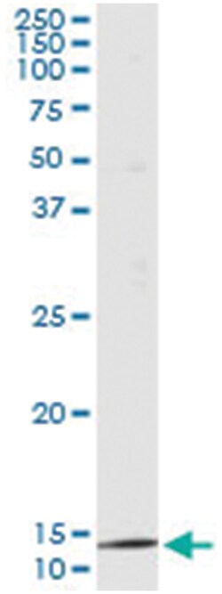 PTH, Human, IP-WB Antibody Pair (PW2), Abnova&trade;