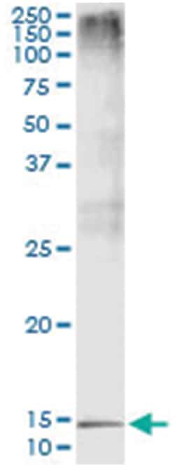PTH, Human, IP-WB Antibody Pair (PW5), Abnova&trade;