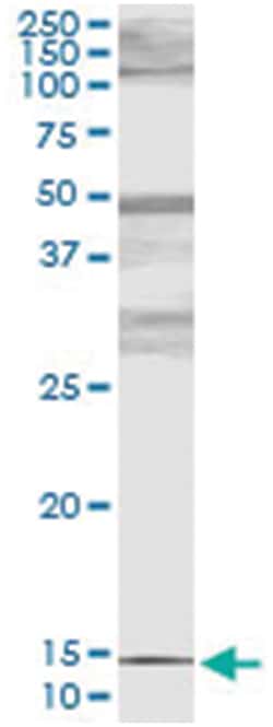 PTH, Human, IP-WB Antibody Pair (PW6), Abnova&trade;