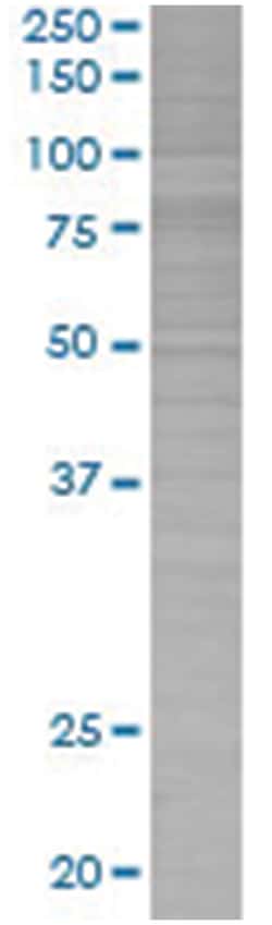 PTGS2 293T Cell Overexpression Lysate (Denatured), Abnova