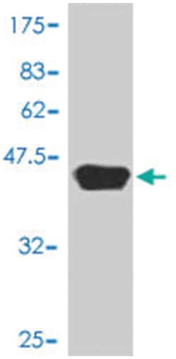 PTK2, Mouse, Polyclonal Antibody, Abnova 50&mu;L; Unlabeled:Antibodies,