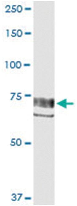 PTK2, Human, IP-WB Antibody Pair (PW2), Abnova™
