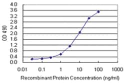 anti-TWF1 Matched Antibody Pair, Abnova
