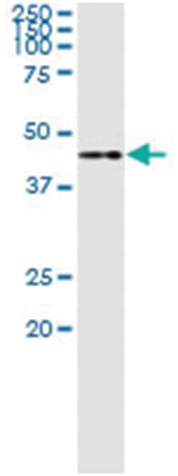 TWF1, Human, IP-WB Antibody Pair (PW3), Abnova&trade;