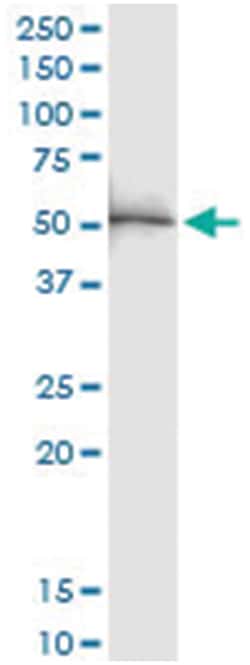 anti-PTPN1, Human, IP-WB Antibody Pair, Abnova&trade;
