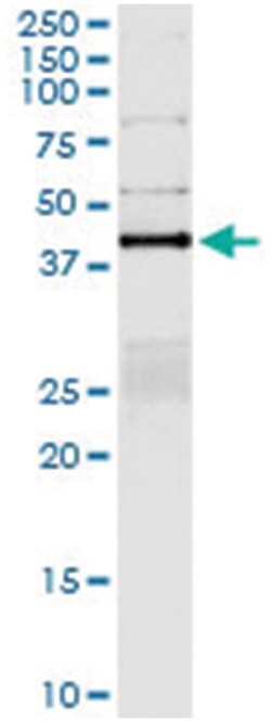 anti-PTPN2, Human, IP-WB Antibody Pair, Abnova&trade;