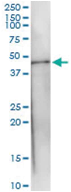 anti-PTPN7, Human, IP-WB Antibody Pair, Abnova&trade;
