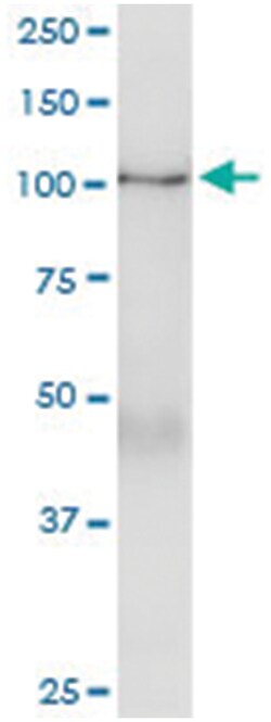 anti-PTPRN, Human, IP-WB Antibody Pair, Abnova™