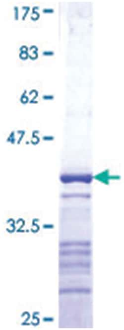 Abnova PTPRN Recombinant Protein 10 &mu;g | Buy Online | Abnova&trade; | Fisher Scientific