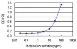 anti-PYCR1 Matched Antibody Pair, Abnova&trade;