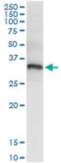 anti-PYCR1, Human, IP-WB Antibody Pair, Abnova 1 Set:Antibodies, Monoclonal/Polyclonal