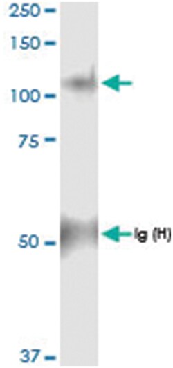 anti-PYGL, Human, IP-WB Antibody Pair, Abnova™