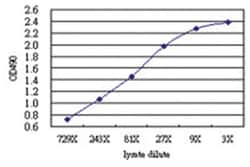 anti-QARS Matched Antibody Pair, Abnova 1 Set, Unlabeled:Antibodies, Monoclonal/Polyclonal