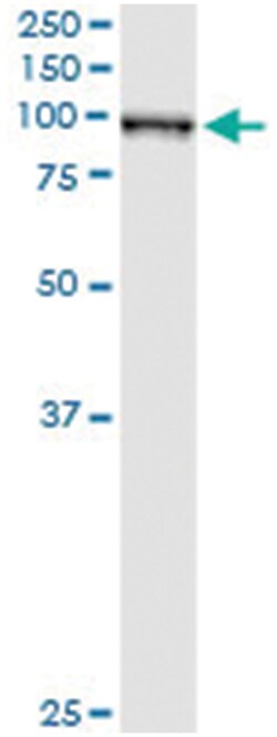 anti-QARS, Human, IP-WB Antibody Pair, Abnova™