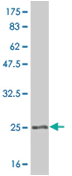 RAB2A, Mouse, Polyclonal Antibody, Abnova 50&mu;L; Unlabeled:Antibodies,