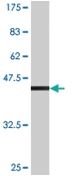 RAC2, Mouse, Clone: M1, Abnova 200 &mu;L | Buy Online | Abnova | Fisher Scientific
