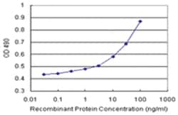 anti-RAD51 Matched Antibody Pair, Ab-1, Abnova