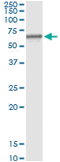 anti-RAG2, Human, IP-WB Antibody Pair, Abnova&trade;