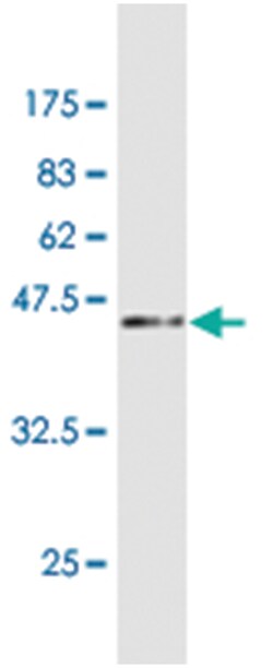 RARRES2 (M25), Mouse anti-Human, Clone: 1G2, Abnova 100 &mu;g | Buy Online | Abnova | Fisher Scientific