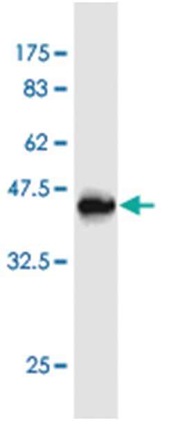 RARRES2 (M25J), Mouse anti-Human, Clone: 1G2, Abnova 50&mu;g; Unlabeled:Antibodies,