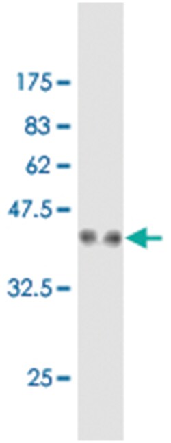 RARRES2 (M26J), Mouse anti-Human, Clone: 4C4, Abnova 50&mu;g; Unlabeled:Antibodies,