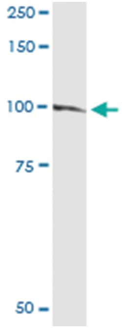 anti-RASA1, Human, IP-WB Antibody Pair, Abnova™