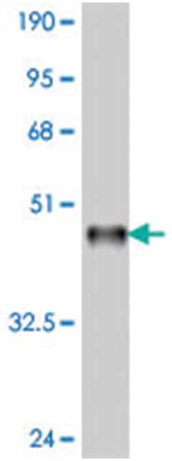 ARID4A, Mouse, Polyclonal Antibody, Abnova 50&mu;L; Unlabeled:Antibodies,