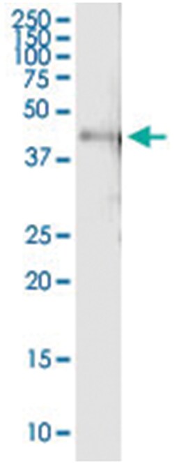 anti-RBMS1, Human, IP-WB Antibody Pair, Abnova&trade;