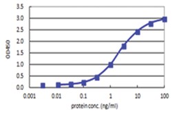 Abnova Corporation RBP4, Human, Matched Antibody Pair (AP42), Abnova™