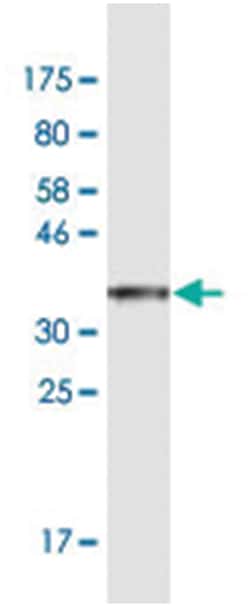 RCVRN, Mouse, Clone: 4E1, Abnova 200&mu;L; Unlabeled:Antibodies, Monoclonal