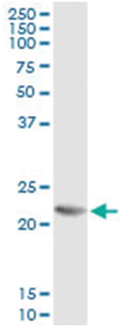 RCVRN, Human, IP-WB Antibody Pair (PW2), Abnova&trade;