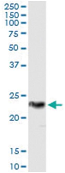 RCVRN, Human, IP-WB Antibody Pair (PW3), Abnova™