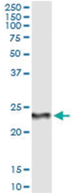 RCVRN, Human, IP-WB Antibody Pair (PW4), Abnova™