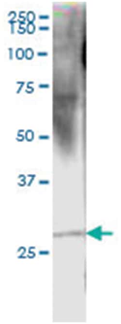 RCVRN, Human, IP-WB Antibody Pair (PW5), Abnova 1 Set:Antibodies, Monoclonal/Polyclonal