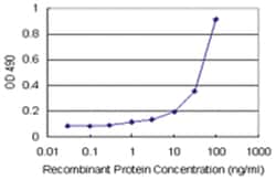 REG1A, Human, Matched Antibody Pair (AP42), Abnova&trade;