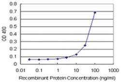 REG1A, Human, Matched Antibody Pair (AP43), Abnova&trade;