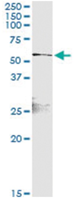 anti-RELB, Human, IP-WB Antibody Pair, Abnova™