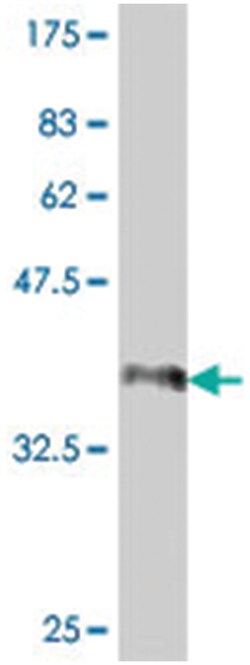 RFC1, Mouse, Polyclonal Antibody, Abnova 50&mu;L; Unlabeled:Antibodies,