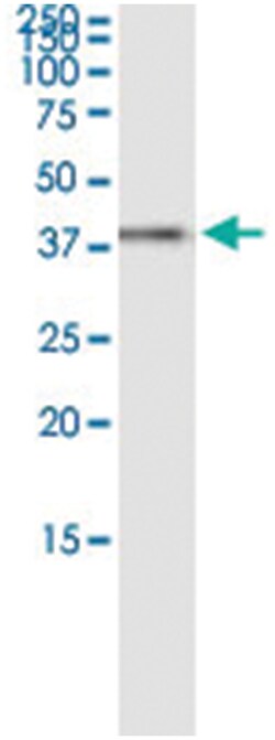 anti-RFC4, Human, IP-WB Antibody Pair, Abnova 1 Set:Antibodies, Monoclonal/Polyclonal