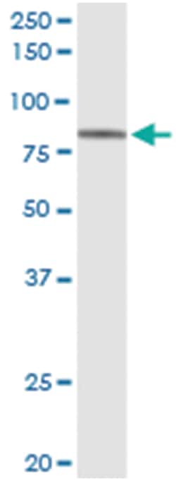 anti-RFX5, Human, IP-WB Antibody Pair, Abnova&trade;
