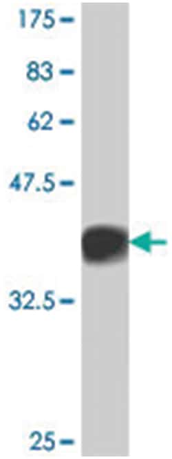 RGS16, Mouse, Polyclonal Antibody, Abnova 50&mu;L; Unlabeled:Antibodies,